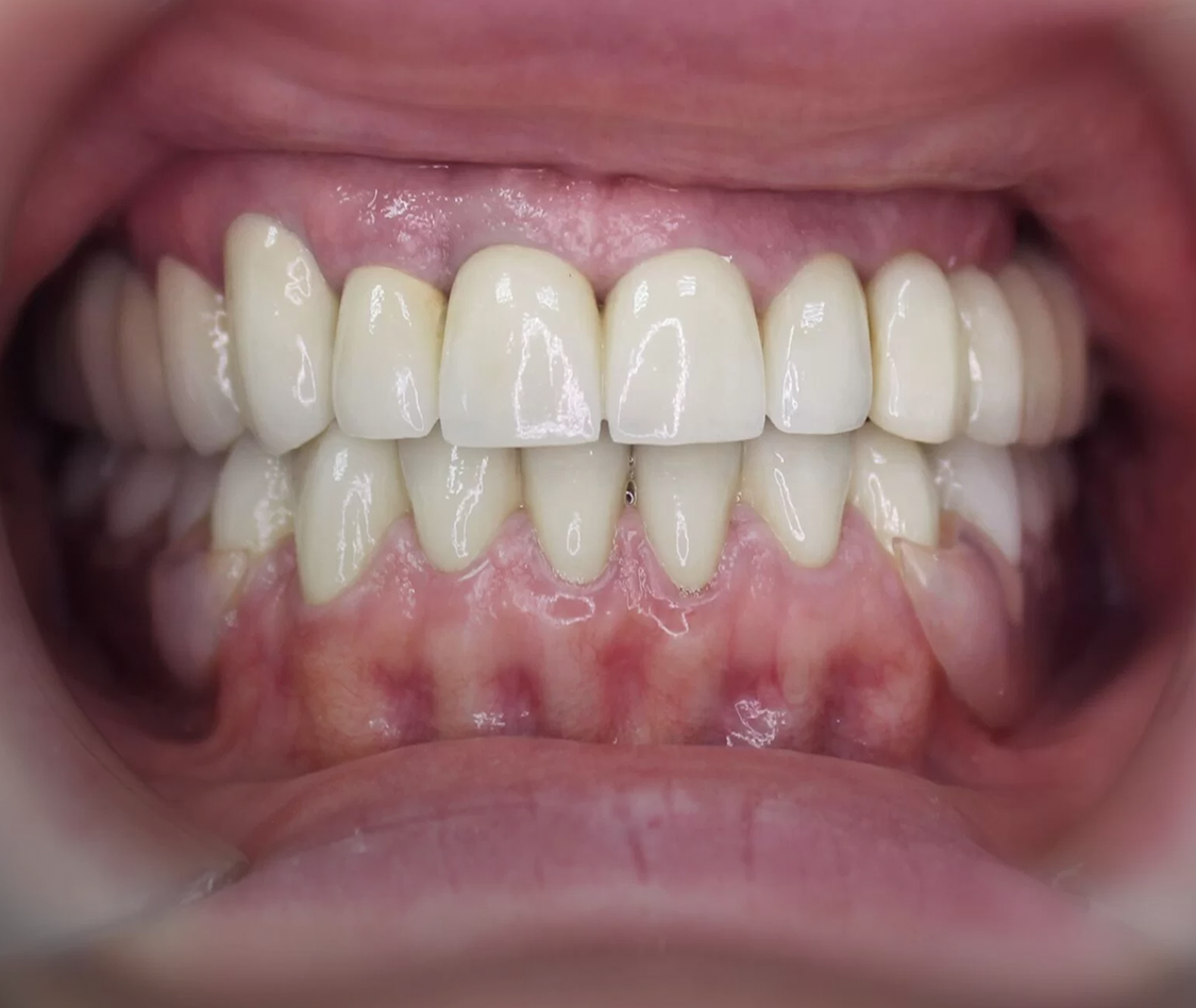 Услуги компании DENTAL GEN